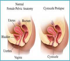 Woman Urology: What Is The Procedure Of Urology?